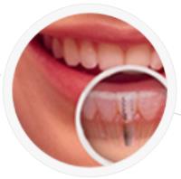 ProSmiles Abbotsford Dental Clinic image 4